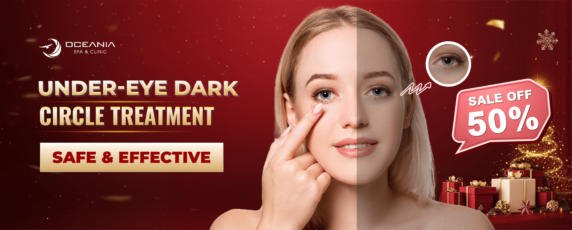 under eye dark circle treatment