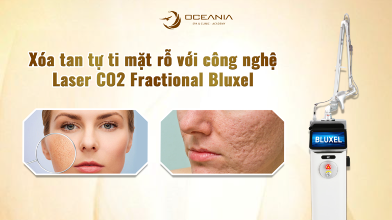Xóa Tan Tự Ti Mặt Rỗ Với Công Nghệ Laser CO2 Fractional Bluxel ( bản ngang )